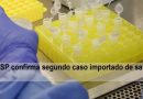 SP confirma o segundo caso importado de sarampo no território paulista